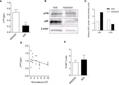 CDK11 Promotes Cytokine-Induced Apoptosis in Pancreatic Beta Cells Independently of Glucose Concentration and Is Regulated by Inflammation in the NOD Mouse Model